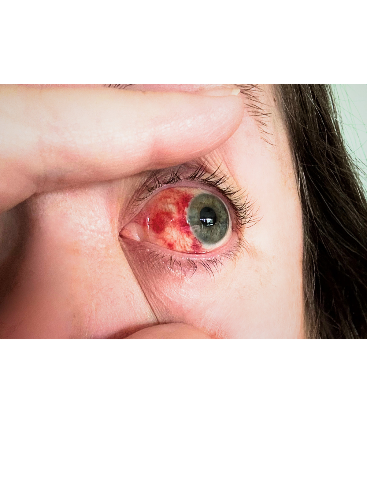 When to Seek Emergency Eye Care